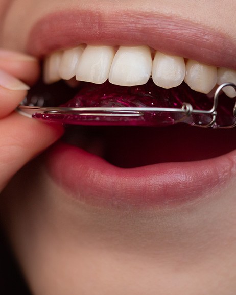 Retainers on a counter