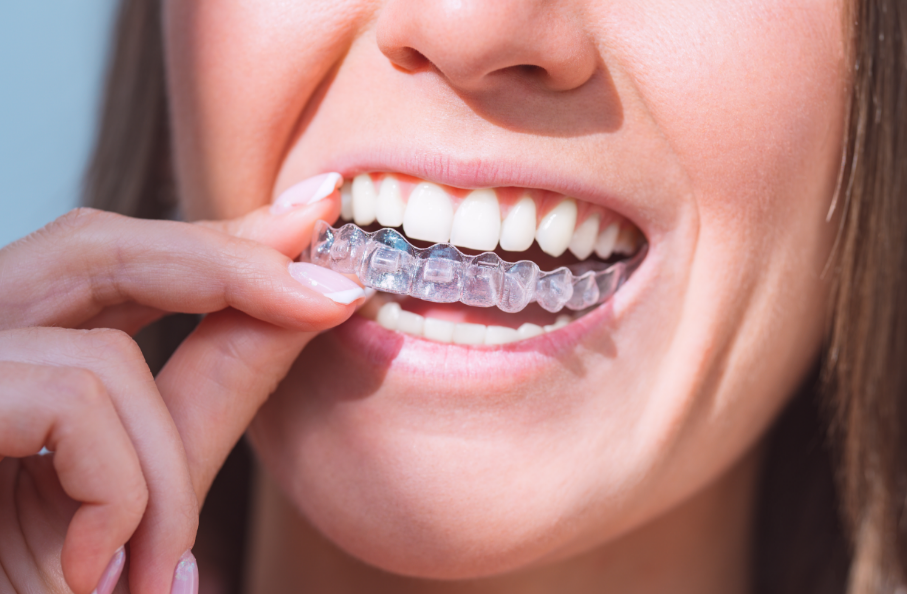 Woman putting retainer in