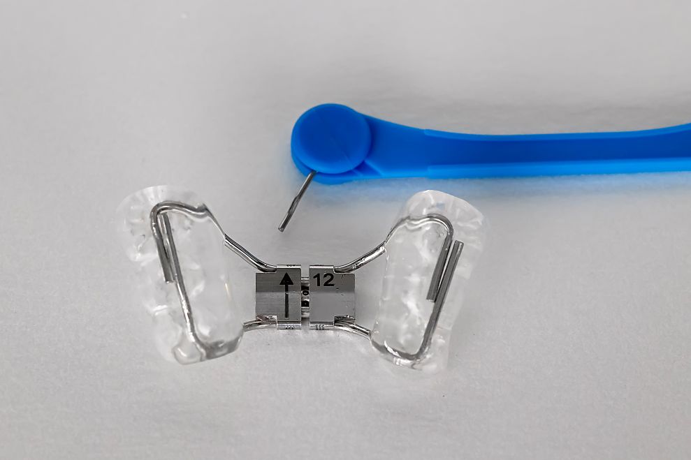 A palate expander and turnkey